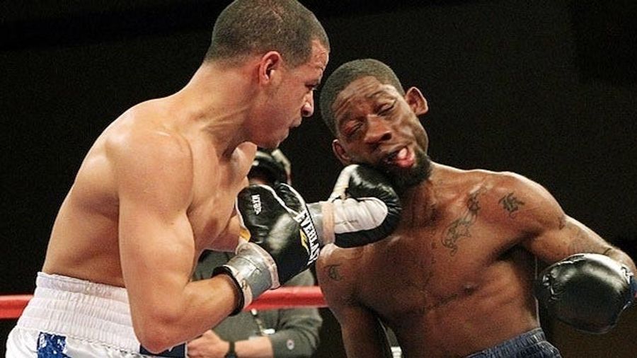 Boxer Teon Kennedy Gets His Face Rearranged