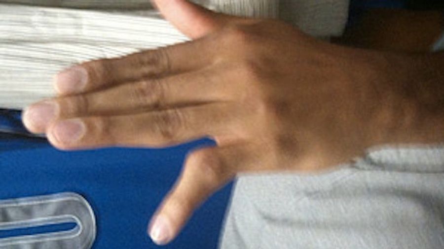 Look At Shawn Marion's Disgustingly Dislocated Pinkie