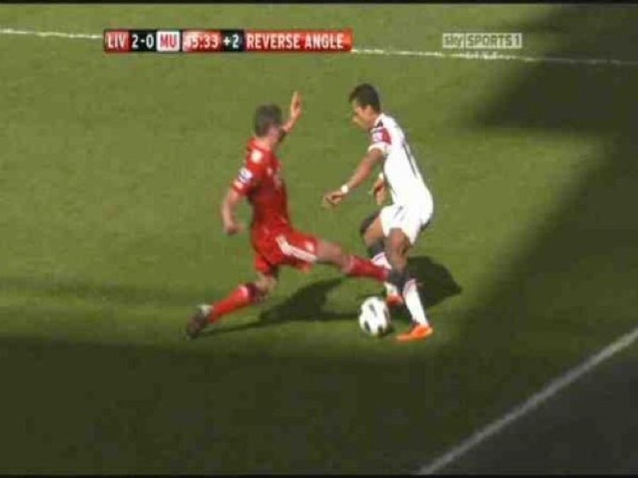 Man U Player Suffers "Horrific Injury That Cut To The Bone"