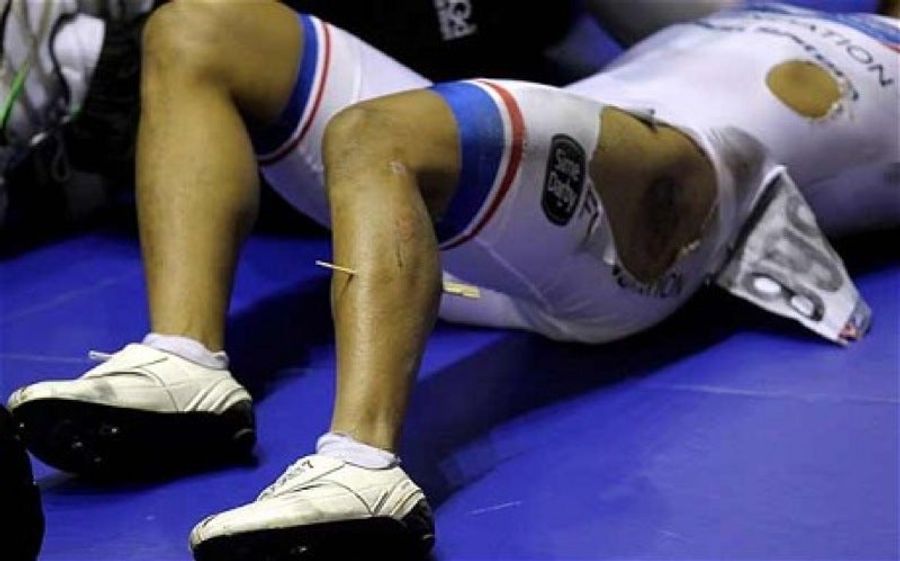 Cyclist Finishes Third Despite 8-Inch Calf Splinter