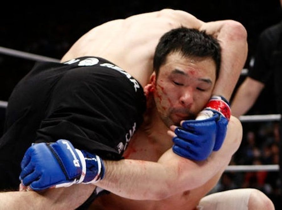 MMA Fighter Who Lost Ear Has Mangled Remains Reattached