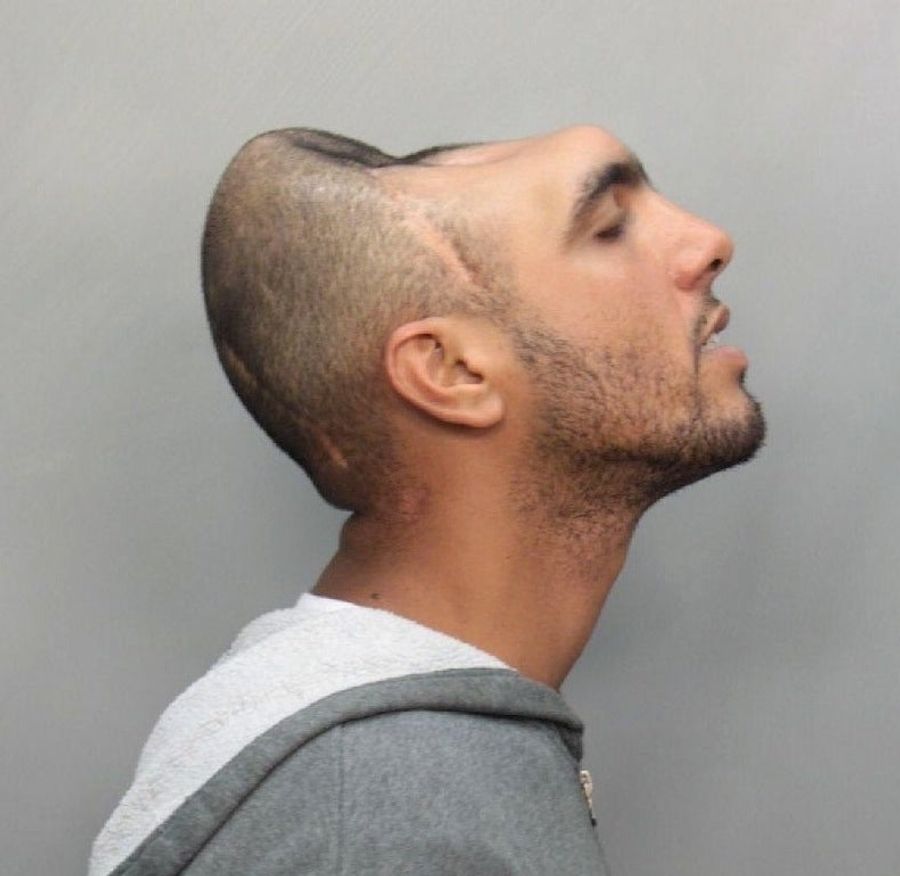 Half-Headed Man Takes World's Most Bizarre Mugshot