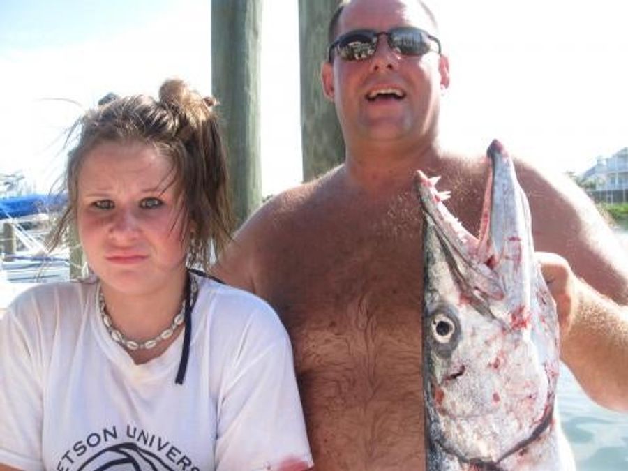 Father Of The Year Makes Daughter Pose With Barracuda That Ripped Her Flesh Open