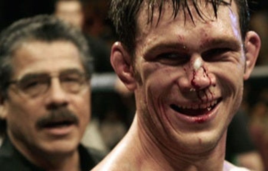 &quot;It Looked Like A Butterflied Shrimp&quot;: A Cutman&#39;s Tour Of 12 Terrible Fight Wounds