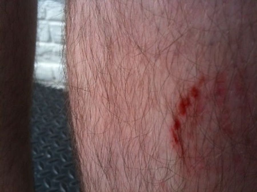 Blood Writes: I Bumped Into A Banana Crate