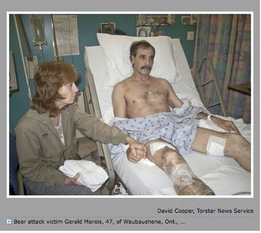 Dear Commenters: See This Guy? He Was Mauled By A Fucking Bear. You&#39;re Next.
