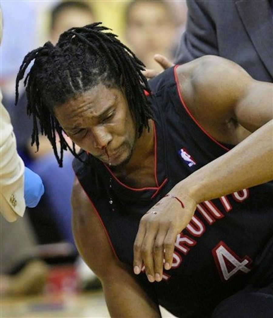 Okay, Maybe Chris Bosh Wasn't Flopping