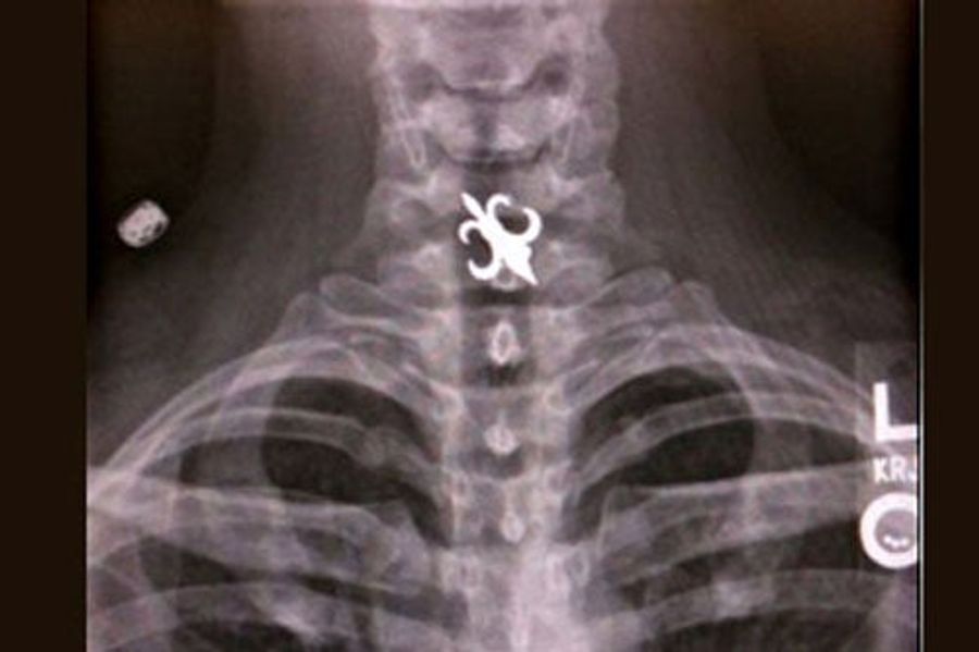 Is That A Fleur de Lis In Your Throat Or Are You Just Drunk?