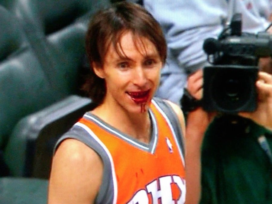 Steve Nash In: White Of The Living Dead