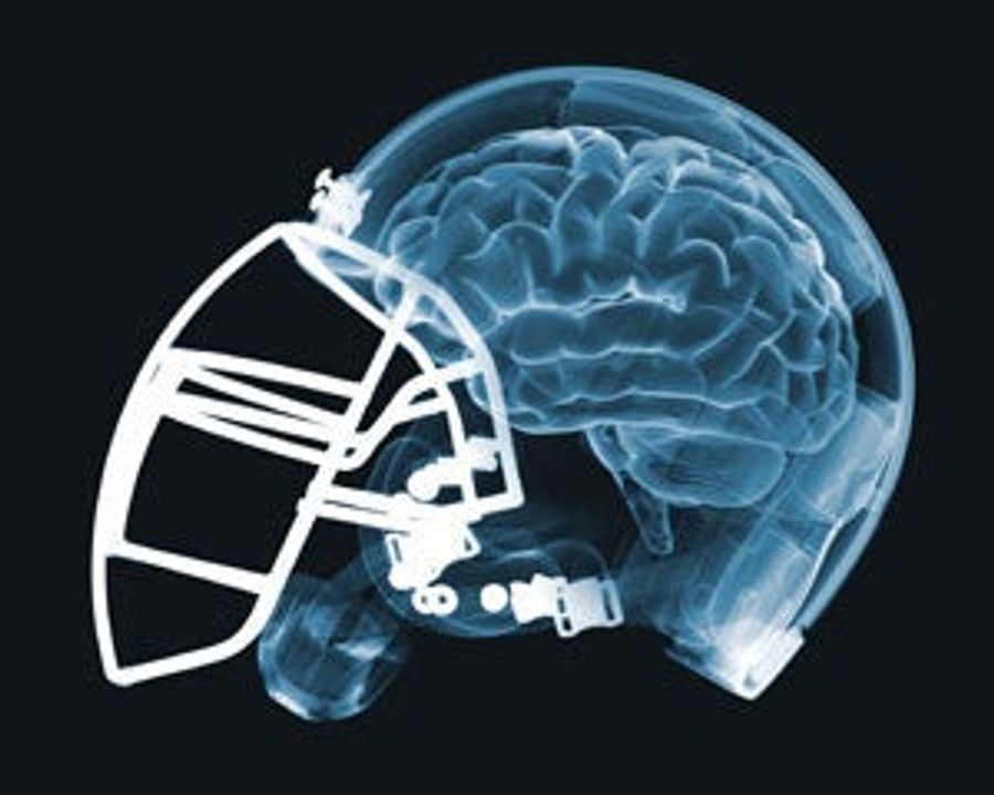 NFL Dementia Study Is Not Exactly "Scientific"