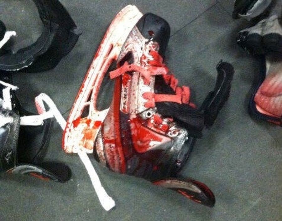 A Scary Minor League Hockey Injury Led To This Blood-Covered Skate