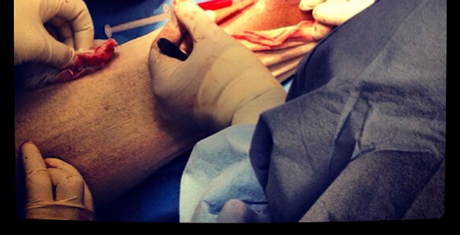 Kobe Bryant Shares Disgusting Photo Of His Achilles Surgery