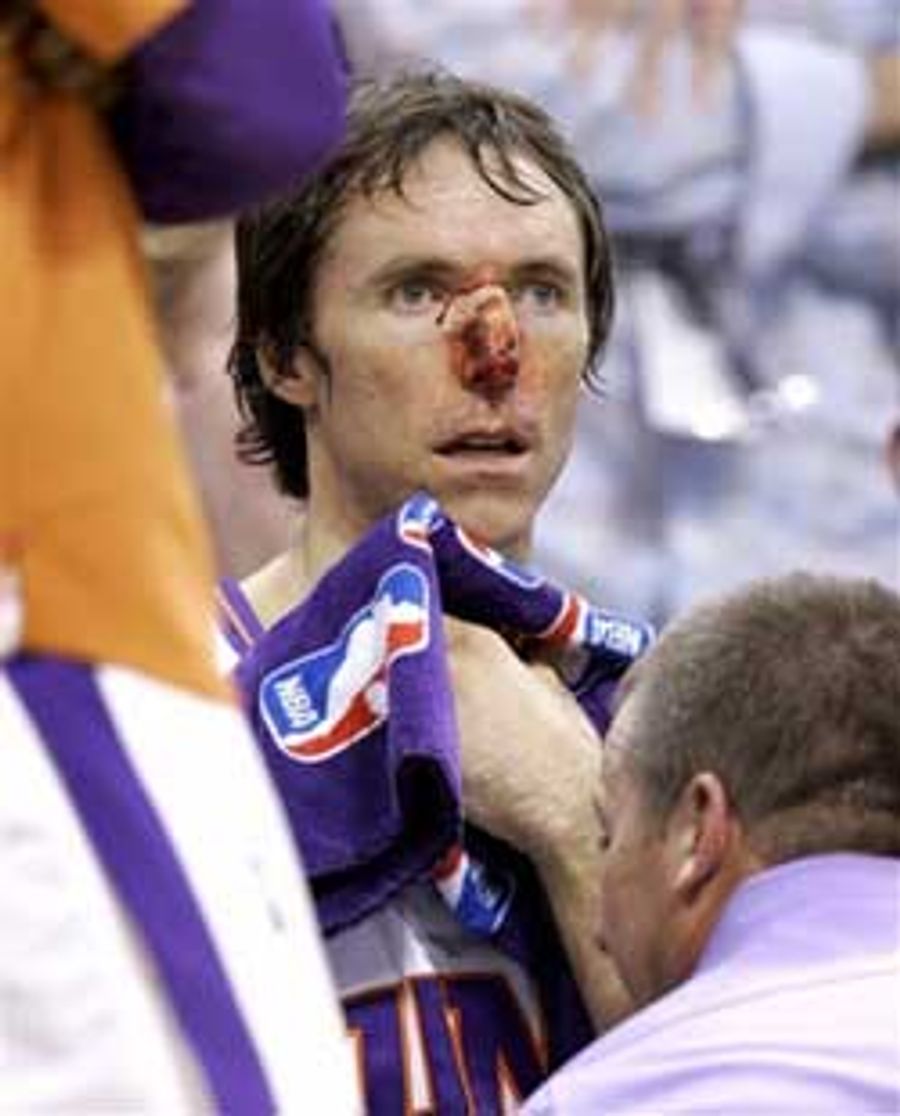 Steve Nash, Definitely A Bleeder