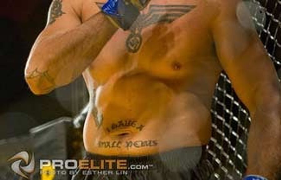 What&#39;s The Best Way To Get Rid Of A Tattoo? Oh, Yeah: OPEN FLAME.