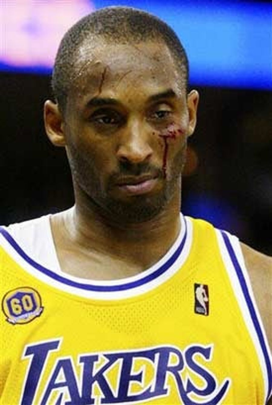 Kobe Cries Tears Of Blood, Lakers Win