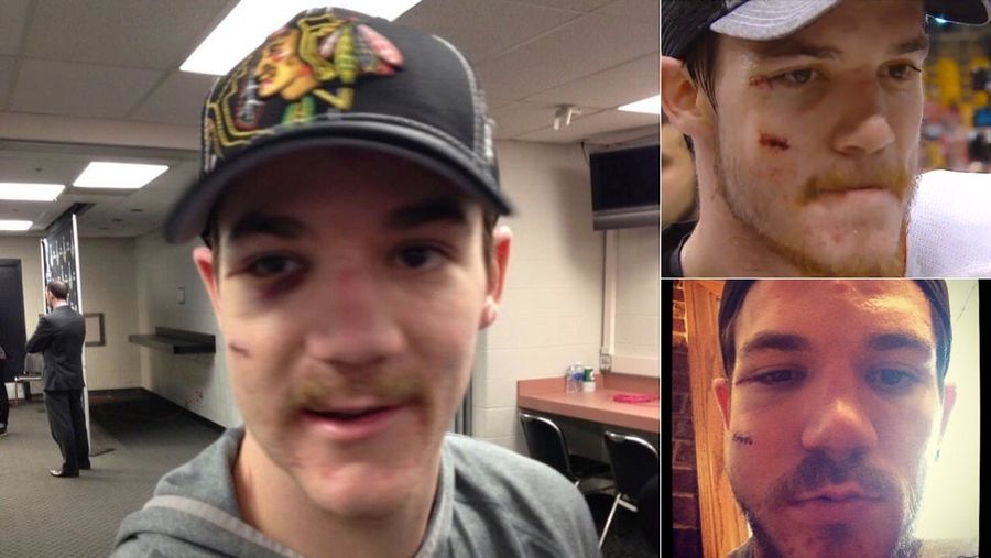 Andrew Shaw Is More Swelling Than Man