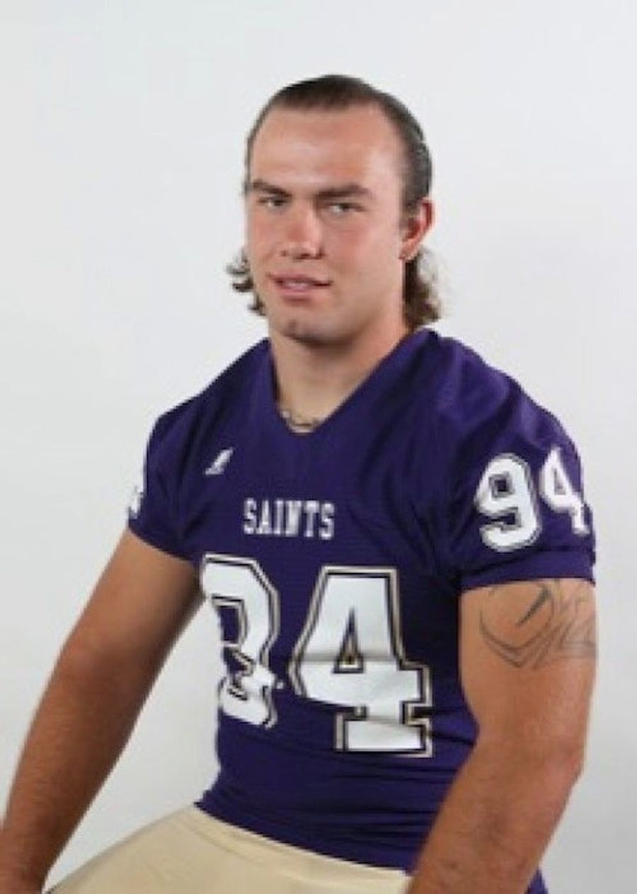 Photos Of College Football Player&#39;s Bloomin’ Onion Burns [GRAPHIC]
