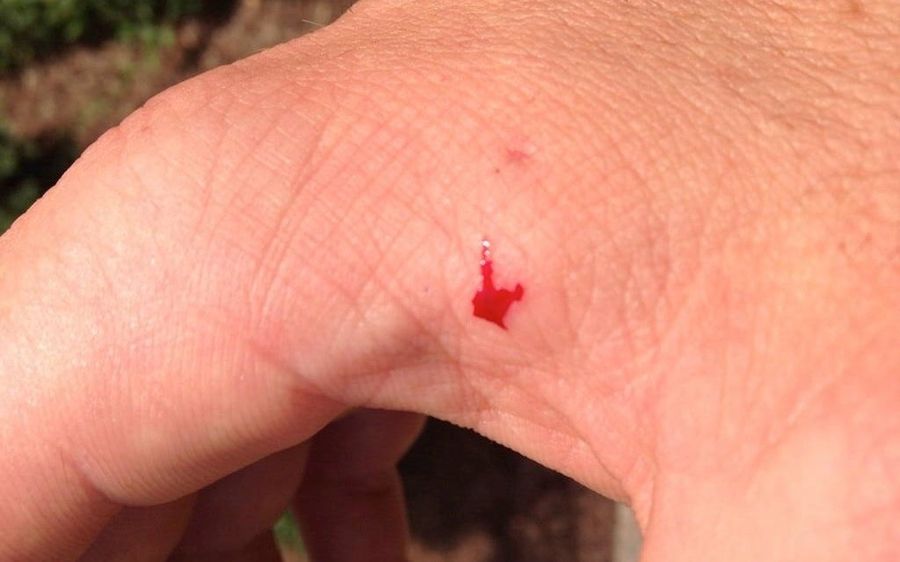 Mike Fisher Bitten While Saving Carrie Underwood From Chipmunk