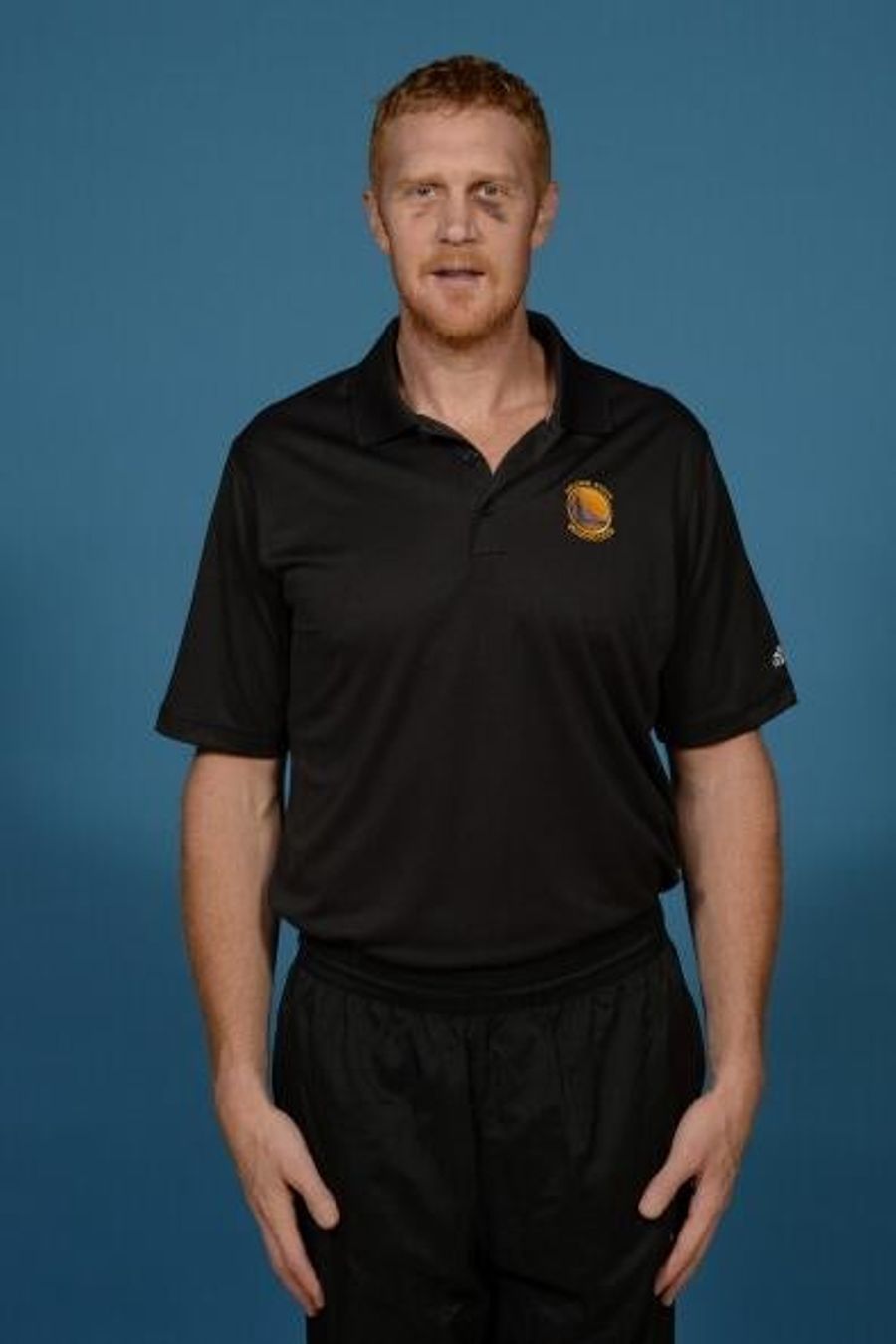 Brian Scalabrine Showed Up To Media Day With A Black Eye