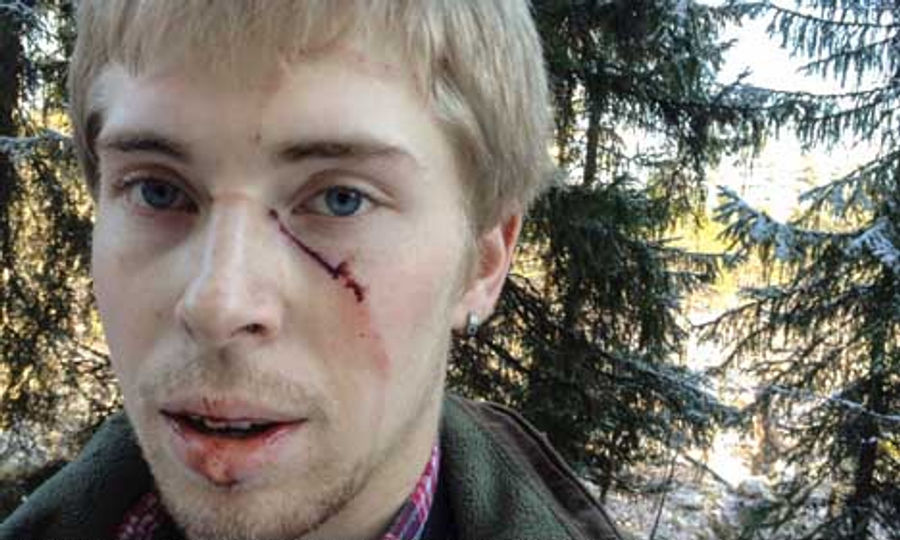Swedish Bandy Goalkeeper Survives Bear Attack