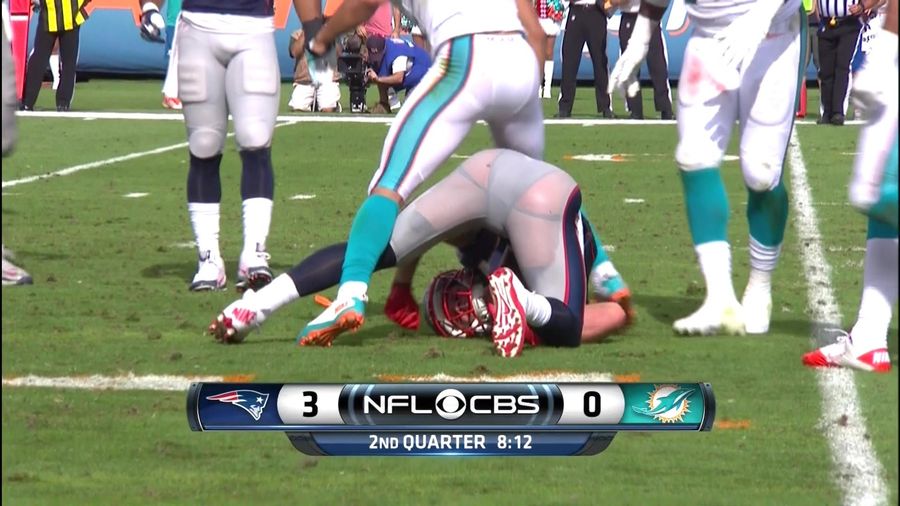 The Patriots Came To Regret Hiring Lululemon To Make Their Pants