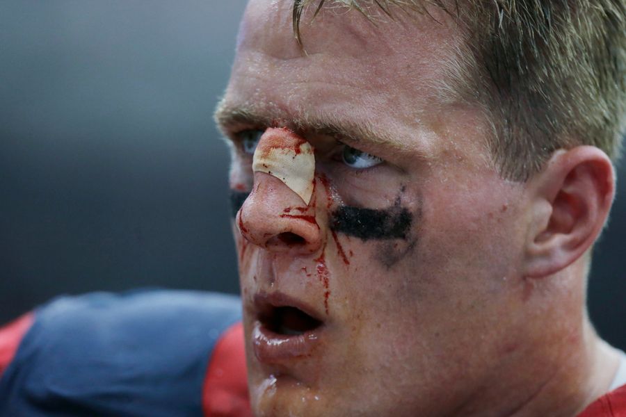 J.J. Watt's Mom Wants Him To Fix His Nose