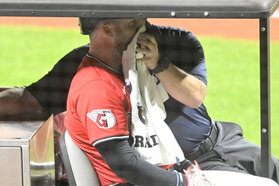 Guardians' David Fry has broken nose, facial fractures