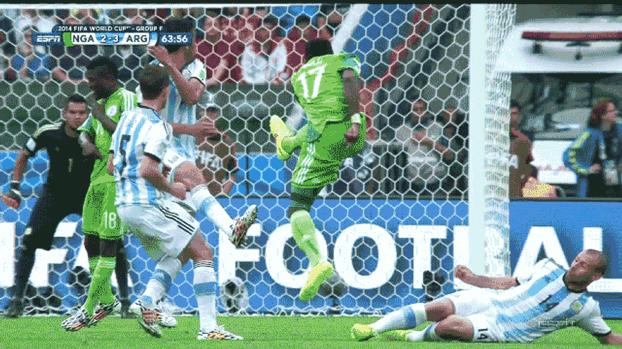 Nigerian Soccer Player Gets His Arm Busted By His Teammate's Shot