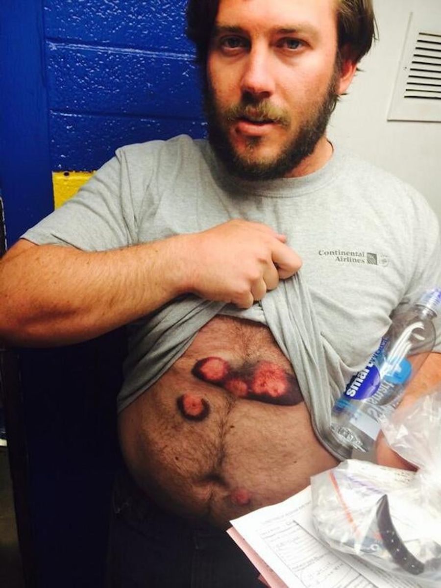 Arizona Bro Takes So Many Pepper Balls To Chest Before Being Restrained