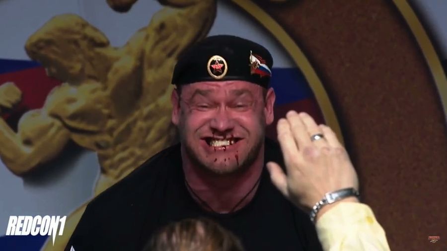 Strongman's Face Starts Gushing Blood During Deadlift<em></em>