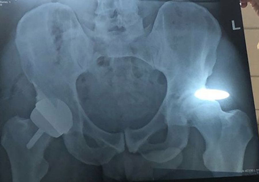Andy Murray Shares Status Updates On His Hip, Dong<em></em>