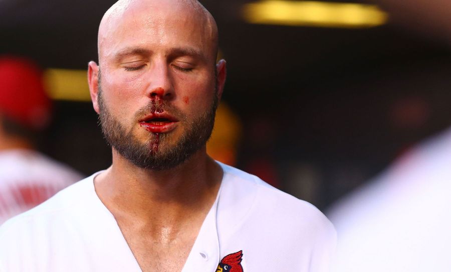Matt Holliday Leaves Game After Taking A Pitch Right In The Nose