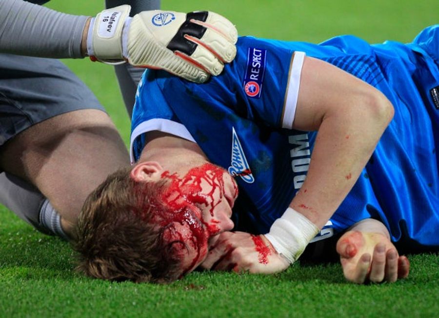 Zenit Player's Face Was A River Of Blood After Getting Kneed In Head