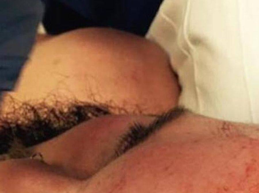 Look At This Wrestler's Gross Head Wound, Or Don't. Do What You Want.