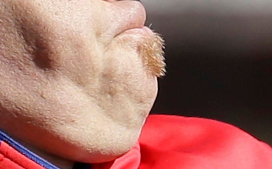 Whose Disgusting Baseball Chin Is This?