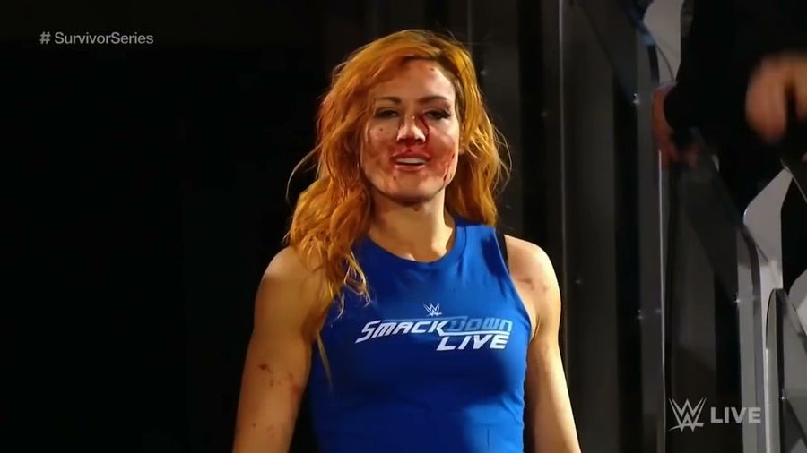 "Broken Face" And All, Becky Lynch Is Suddenly The Biggest Star In WWE