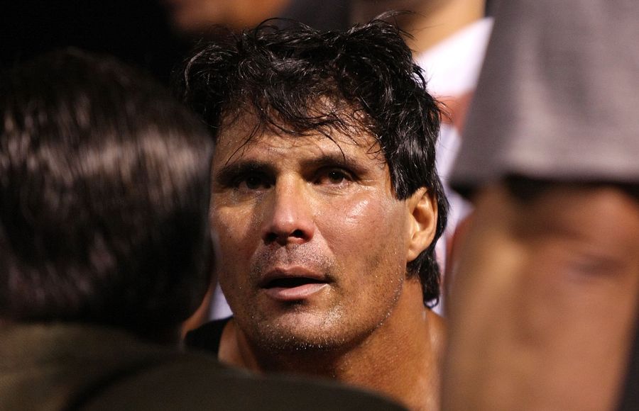 Jose Canseco&#39;s Gross-Smelling Finger Fell Off [Graphic Update]