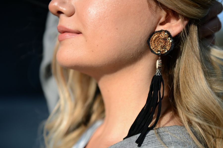 I Had An Earring Back Stuck In My Earlobe For Two Years