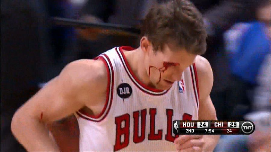 Reminder: Bleeding From The Eye Is Good For Your Game