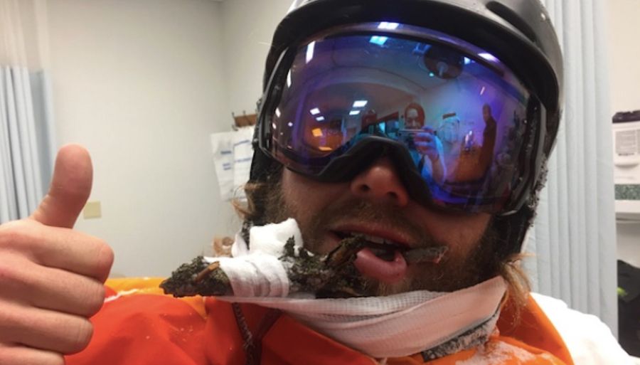 Ski Bro Extremely Chill About Getting Face Impaled By Tree Branch<em></em>