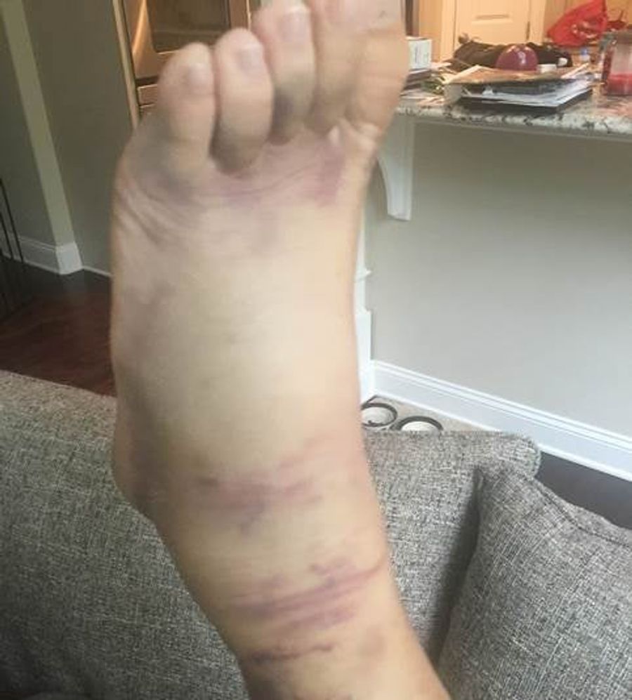 It&#39;s Important To Have Good Ankle Support When Celebrating A Championship