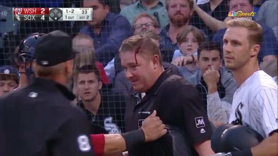 Home Plate Umpire Takes A Backswing To The Head In Nationals-White Sox