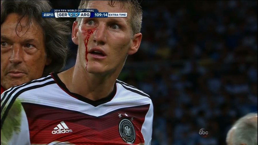 Schweinsteiger: Bloodied