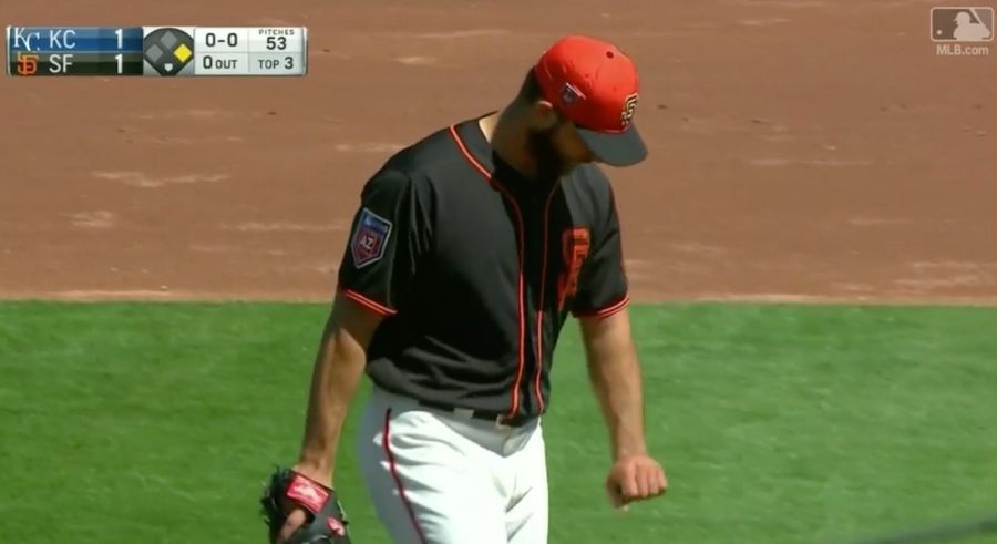 Madison Bumgarner's Pitching Hand Is Broken After Getting Smacked With A Line Drive