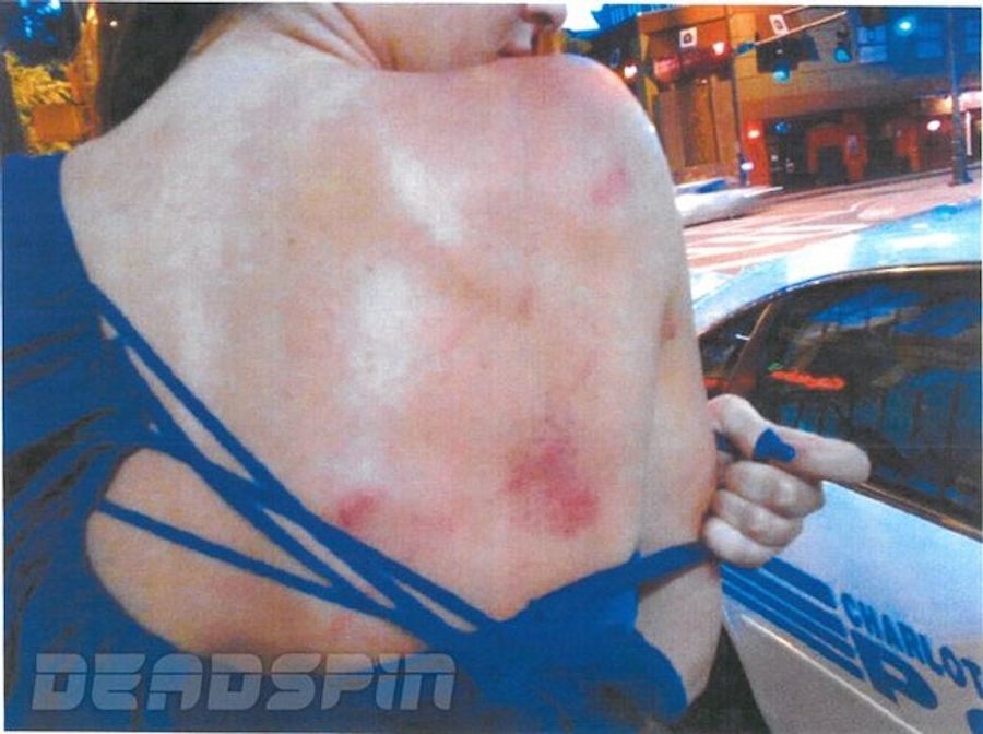 Greg Hardy On Police Photos: "Pictures Are Pictures And They Can Be Made To Look Like Whatever They Want To”