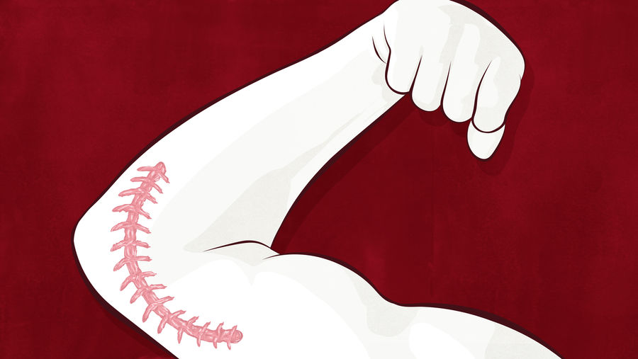 Inside The Room For Tommy John Surgery, Baseball&#39;s Most Important Cut 