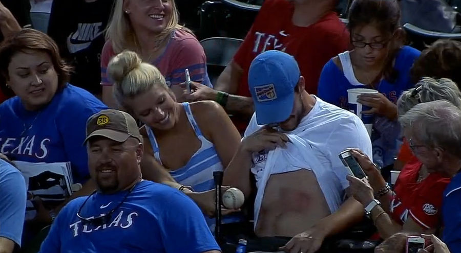 Rangers Fan Gets Hit By A Foul Ball, Grows Big Ol' Bruise
