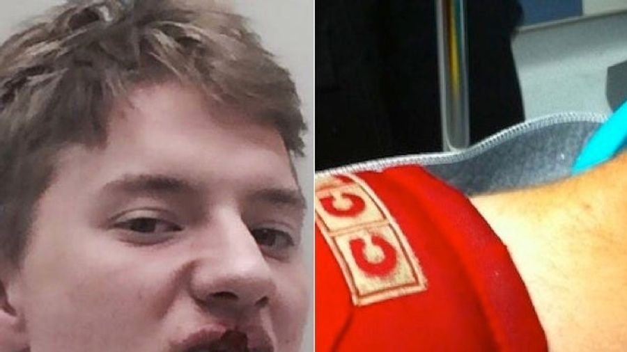 These Gruesome Hockey Injuries Are Very Bad; Hockey Is Bad