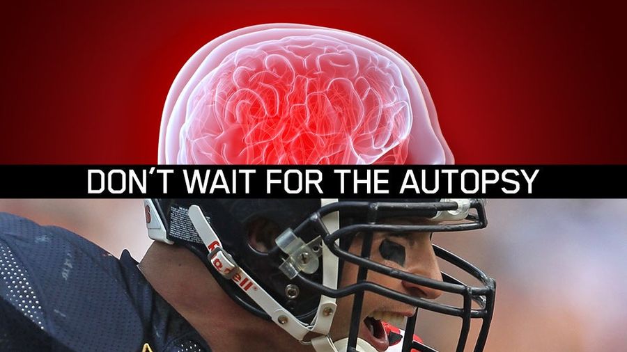Can Science See Inside An NFL Player's Skull Before It's Too Late?