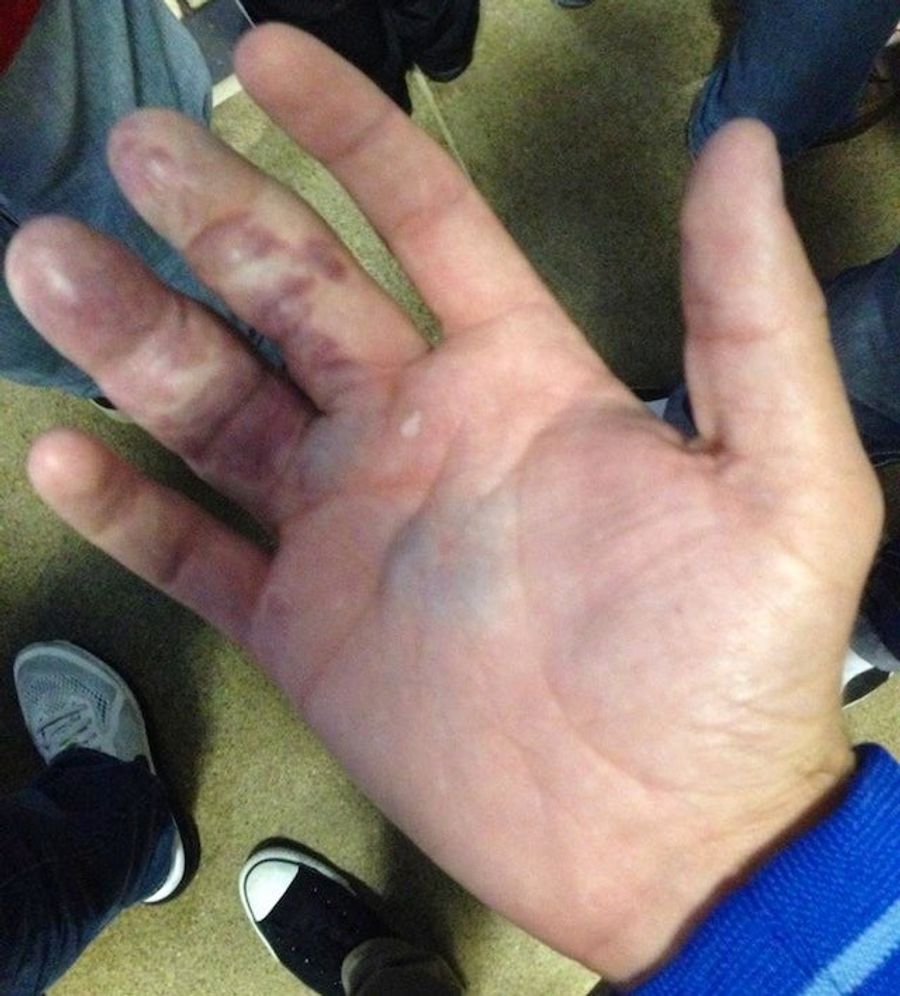 This Is What Happens When You Try To Bare-Hand A Giancarlo Stanton Homer [Update]